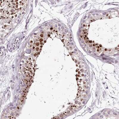 Immunohistochemistry-Paraffin: MENT Antibody [NBP2-32683]