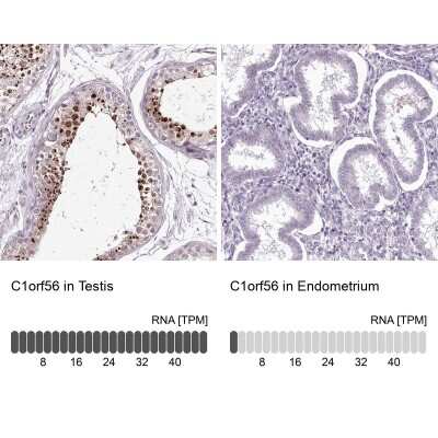 Immunohistochemistry-Paraffin: MENT Antibody [NBP2-32683]