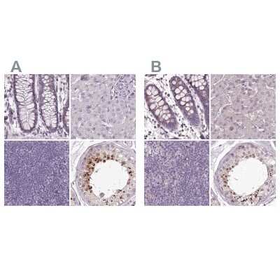 Immunohistochemistry-Paraffin: MENT Antibody [NBP2-32683]