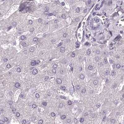 Immunohistochemistry-Paraffin: MENT Antibody [NBP2-32683]