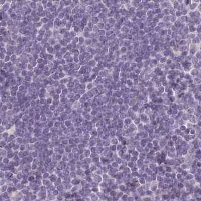 Immunohistochemistry-Paraffin: MENT Antibody [NBP2-32683]