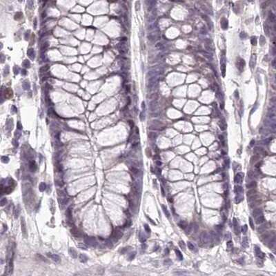 Immunohistochemistry-Paraffin: MENT Antibody [NBP2-32683]