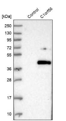 Western Blot: MENT Antibody [NBP1-82174]