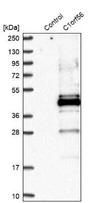 Western Blot: MENT Antibody [NBP2-32683]