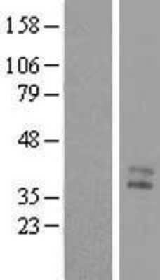 Western Blot: MENT Overexpression Lysate [NBL1-08323]