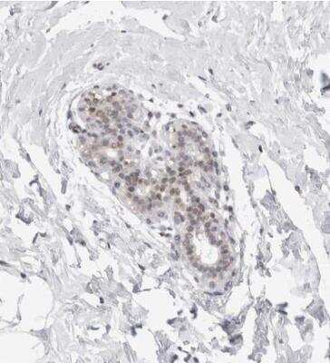 Immunohistochemistry-Paraffin: ERRF Antibody [NBP1-81157]