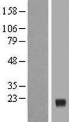 Western Blot: ERRF Overexpression Lysate [NBL1-08326]