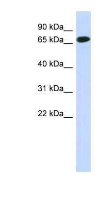 Western Blot: CCDC185 Antibody [NBP1-56727]