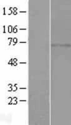 Western Blot: CCDC185 Overexpression Lysate [NBL1-08327]