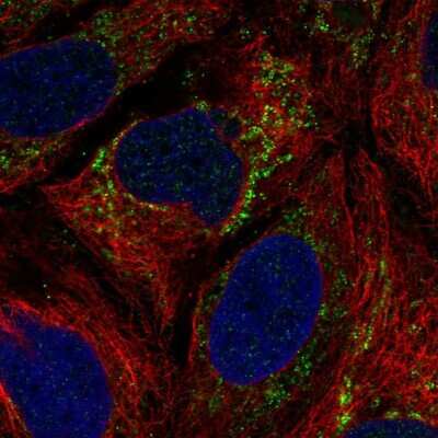 Immunocytochemistry/ Immunofluorescence: IBA57 Antibody [NBP2-55157]