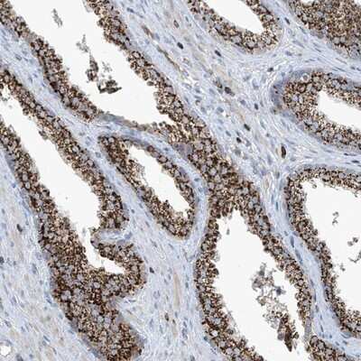 Immunohistochemistry-Paraffin: IBA57 Antibody [NBP1-94027]