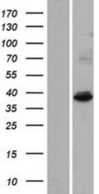 Western Blot: IBA57 Overexpression Lysate [NBP2-08764]