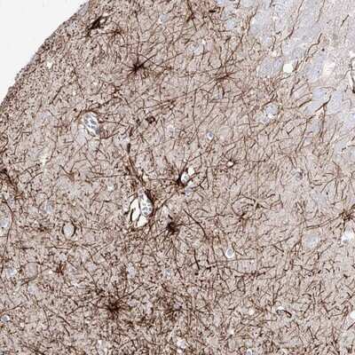 Immunohistochemistry-Paraffin: C1orf74 Antibody [NBP1-83571]