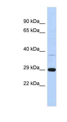 Western Blot: C1orf74 Antibody [NBP1-70456]