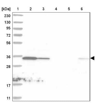 Western Blot: C1orf74 Antibody [NBP1-83571]