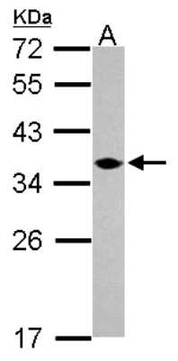 Western Blot: C1orf74 Antibody [NBP2-15642]