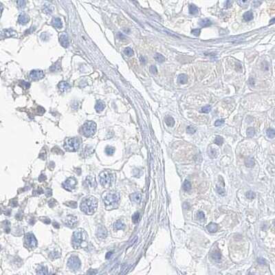 Immunohistochemistry-Paraffin: C1orf87 Antibody [NBP2-48611]