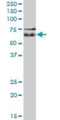 Western Blot: C1orf87 Antibody [H00127795-B01P]