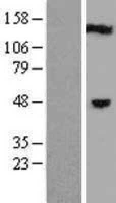 Western Blot: C1orf94 Overexpression Lysate [NBL1-08336]