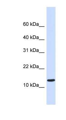 Western Blot: STUM Antibody [NBP1-70457]