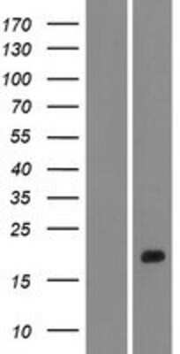 Western Blot: STUM Overexpression Lysate [NBP2-08936]