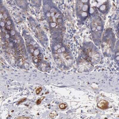 Immunohistochemistry-Paraffin: C1q Antibody [NBP1-87492]