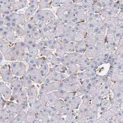 Immunohistochemistry-Paraffin: C1q Antibody [NBP1-87492]