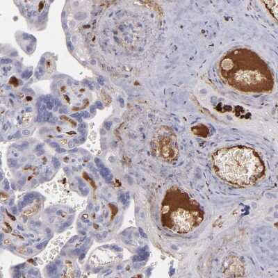 Immunohistochemistry-Paraffin: C1q Antibody [NBP1-87492]