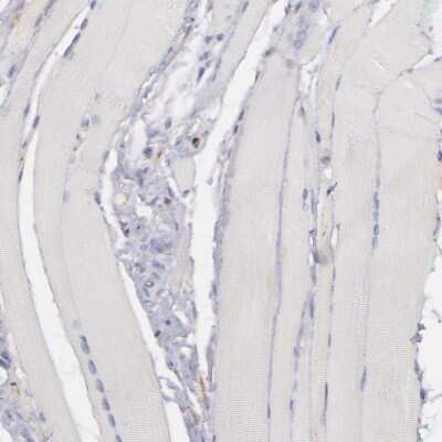 Immunohistochemistry-Paraffin: C1q Antibody [NBP1-87492]