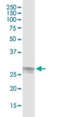 Immunoprecipitation: C1q Antibody [H00000712-D01]
