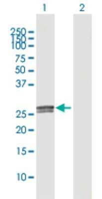 Western Blot: C1q Antibody [H00000712-D01]