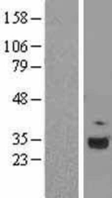 Western Blot: C1q Overexpression Lysate [NBL1-08337]