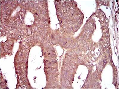 Immunohistochemistry-Paraffin: C1qR1/CD93 Antibody (2F7D11) - BSA Free [NBP2-37310]