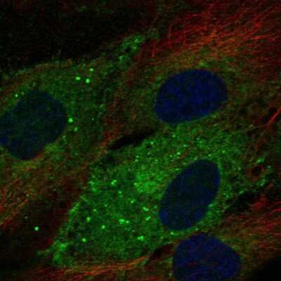 Immunocytochemistry/ Immunofluorescence: C1qR1/CD93 Antibody [NBP1-88317]