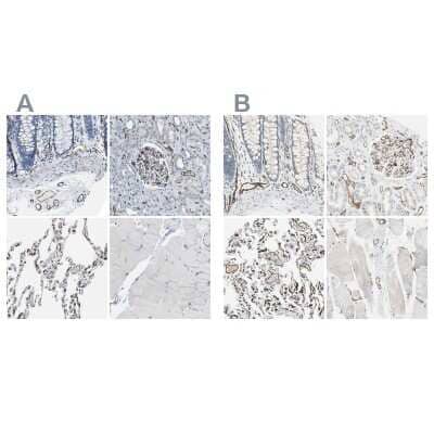 Immunohistochemistry-Paraffin: C1qR1/CD93 Antibody [NBP1-88316]