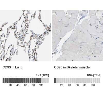 Immunohistochemistry-Paraffin: C1qR1/CD93 Antibody [NBP1-88316]