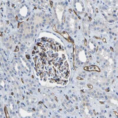 Immunohistochemistry-Paraffin: C1qR1/CD93 Antibody [NBP1-88316]