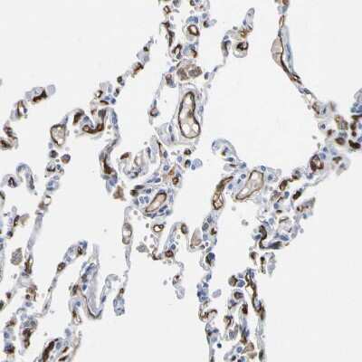 Immunohistochemistry-Paraffin: C1qR1/CD93 Antibody [NBP1-88316]
