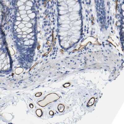 Immunohistochemistry-Paraffin: C1qR1/CD93 Antibody [NBP1-88316]