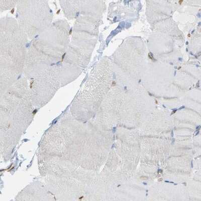 Immunohistochemistry-Paraffin: C1qR1/CD93 Antibody [NBP1-88316]