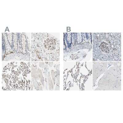 Immunohistochemistry-Paraffin: C1qR1/CD93 Antibody [NBP1-88317]