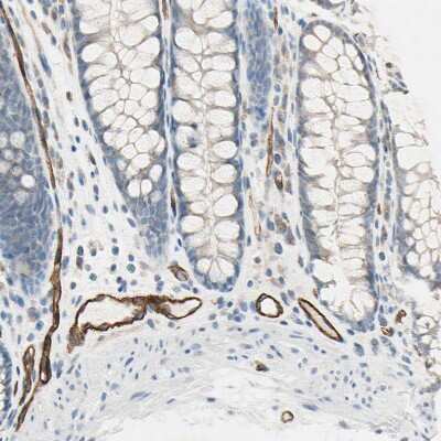Immunohistochemistry-Paraffin: C1qR1/CD93 Antibody [NBP1-88317]