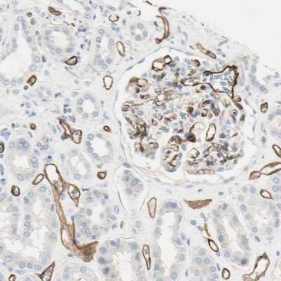 Immunohistochemistry-Paraffin: C1qR1/CD93 Antibody [NBP1-88317]