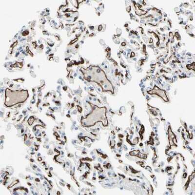 Immunohistochemistry-Paraffin: C1qR1/CD93 Antibody [NBP1-88317]