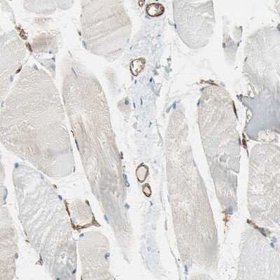 Immunohistochemistry-Paraffin: C1qR1/CD93 Antibody [NBP1-88317]