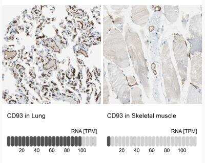 Immunohistochemistry-Paraffin: C1qR1/CD93 Antibody [NBP1-88317]