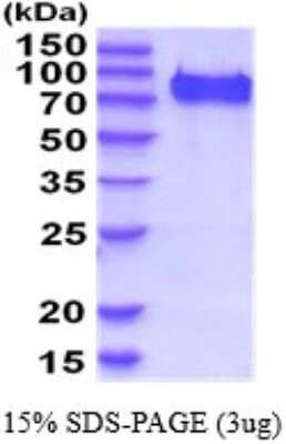 SDS-PAGE: Recombinant Mouse C1qR1/CD93 His Protein [NBP2-52231]