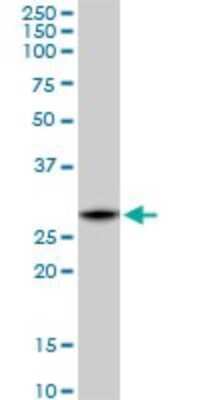 Western Blot: C1qTNF1/CTRP1 Antibody (4A10) [H00114897-M01]