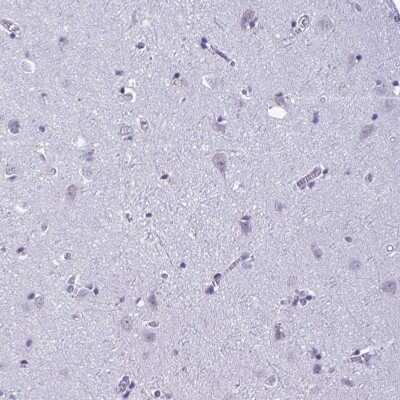 Immunohistochemistry-Paraffin: C1qTNF10/C1qL2 Antibody [NBP2-34090]