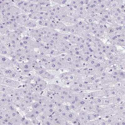 Immunohistochemistry-Paraffin: C1qTNF10/C1qL2 Antibody [NBP2-34090]